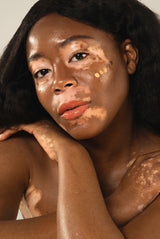 All Skin Colours
